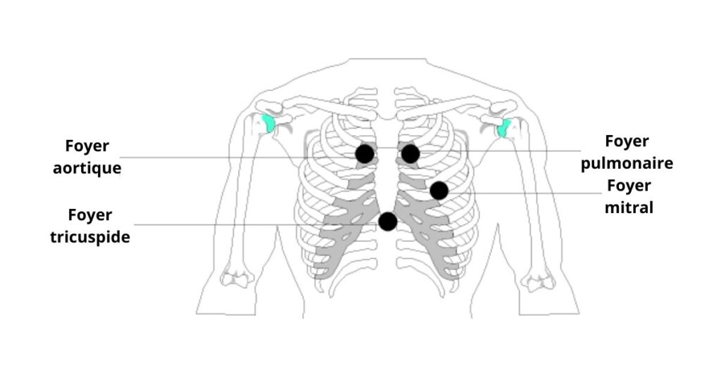 les 4 foyers d'auscultation cardiaque